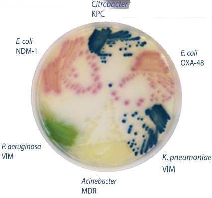 Hylabs̼ùϩˎcUCREzy֬B(yng)